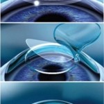 harbin_eye_10